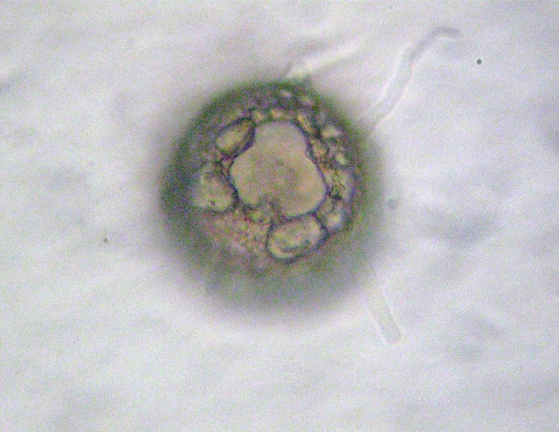 Difflugia verosimilmente gramen